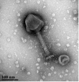 aeruginosa_bacteriophage